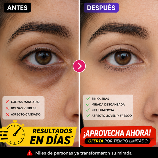 Reduce bolsas y ojeras en minutos y luce una mirada más descansada