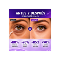 Lift Instantáneo Gel Para Ojos | Reduce Bolsas, Ojeras y Líneas Finas